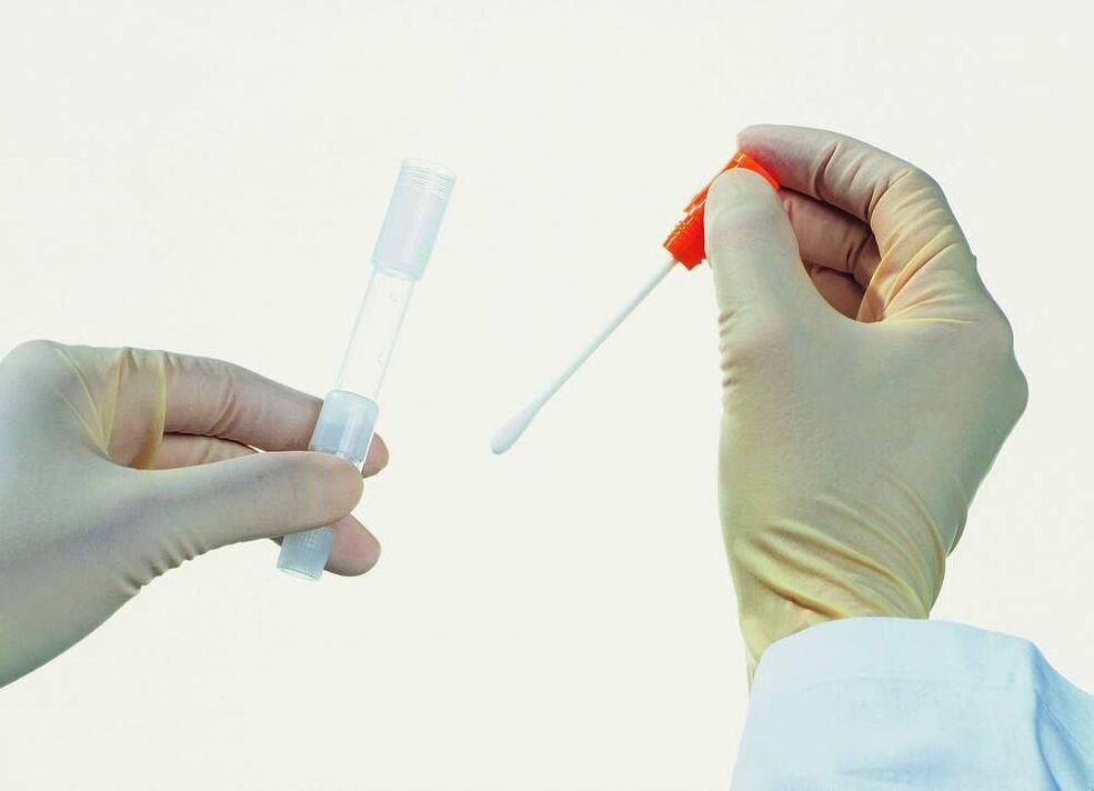 Zbiranje testov za odkrivanje kroničnega prostatitisa